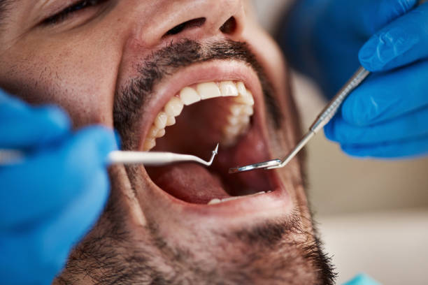 Best Pediatric Emergency Dentist in Clyde, NY